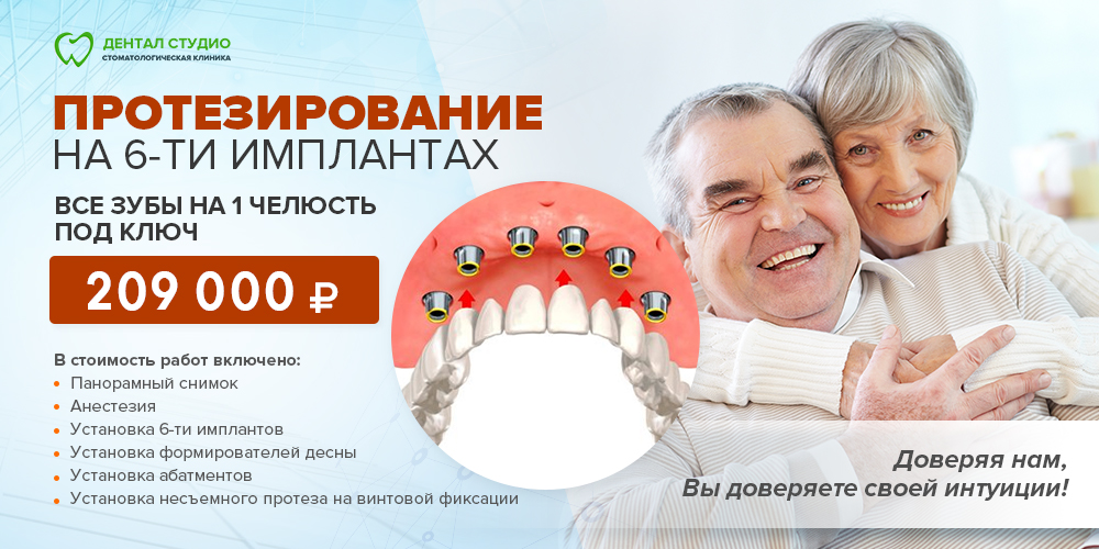 Несъемное протезирование на 6-ти имплантах Несъемное протезирование на 6-ти имплантах